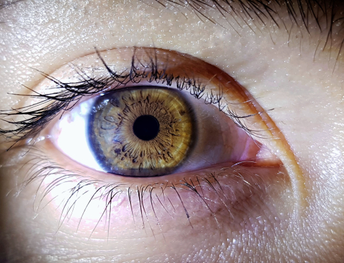 Exposição solar pode aumentar o risco de doenças oculares. Saiba os cuidados que deve ter